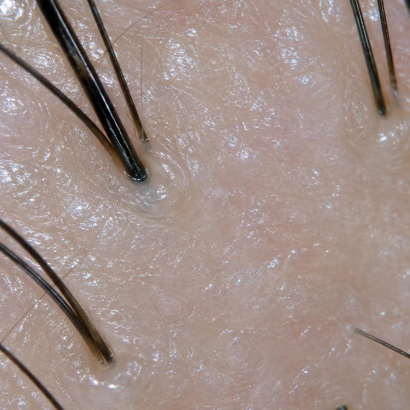 Moisture illustrative close-up