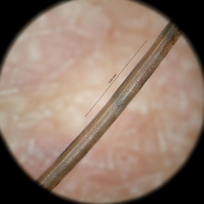 Hair thickness illustrative close-up
